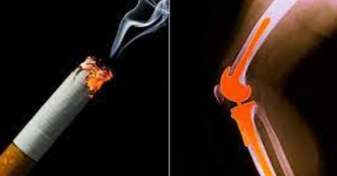 Hút thuốc lá gây nguy hiểm với xương khớp ra sao?