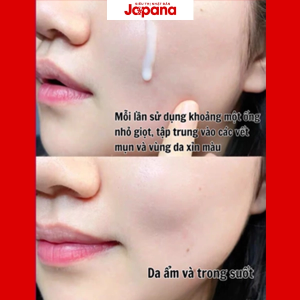 Serum dưỡng trắng SK-II Genoptics Ultraura Essence 50ml