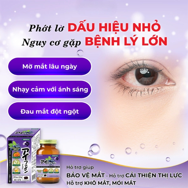 Viên uống bổ mắt Eyefine 30 viên