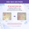 Bột uống trắng da, cải thiện đốm nâu, da xỉn màu Kinohimitsu Prowhite 8G