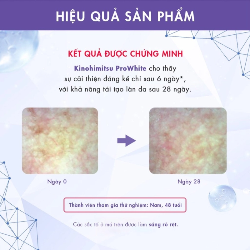 Bột uống trắng da, cải thiện đốm nâu, da xỉn màu Kinohimitsu Prowhite 8G
