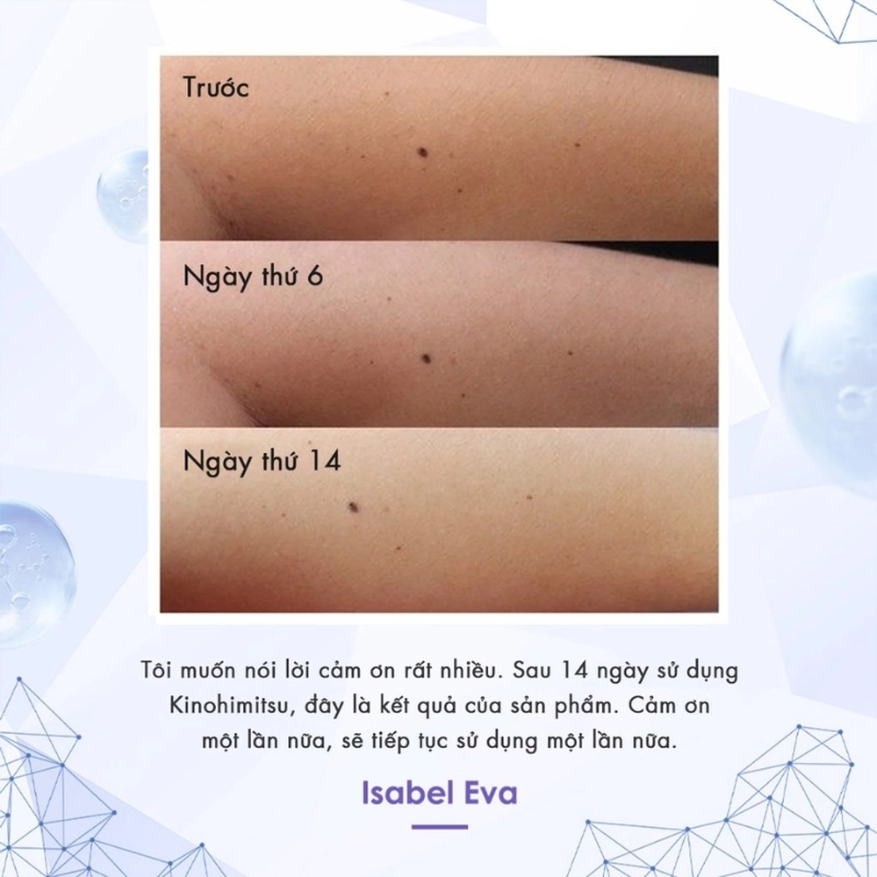 Bột uống trắng da, cải thiện đốm nâu, da xỉn màu Kinohimitsu Prowhite 8G