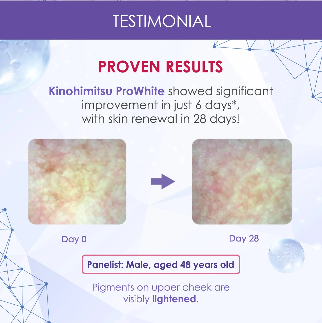 Bột uống tái tạo tế bào gốc và thải độc cơ thể Kinohimitsu Prowhite 30 gói