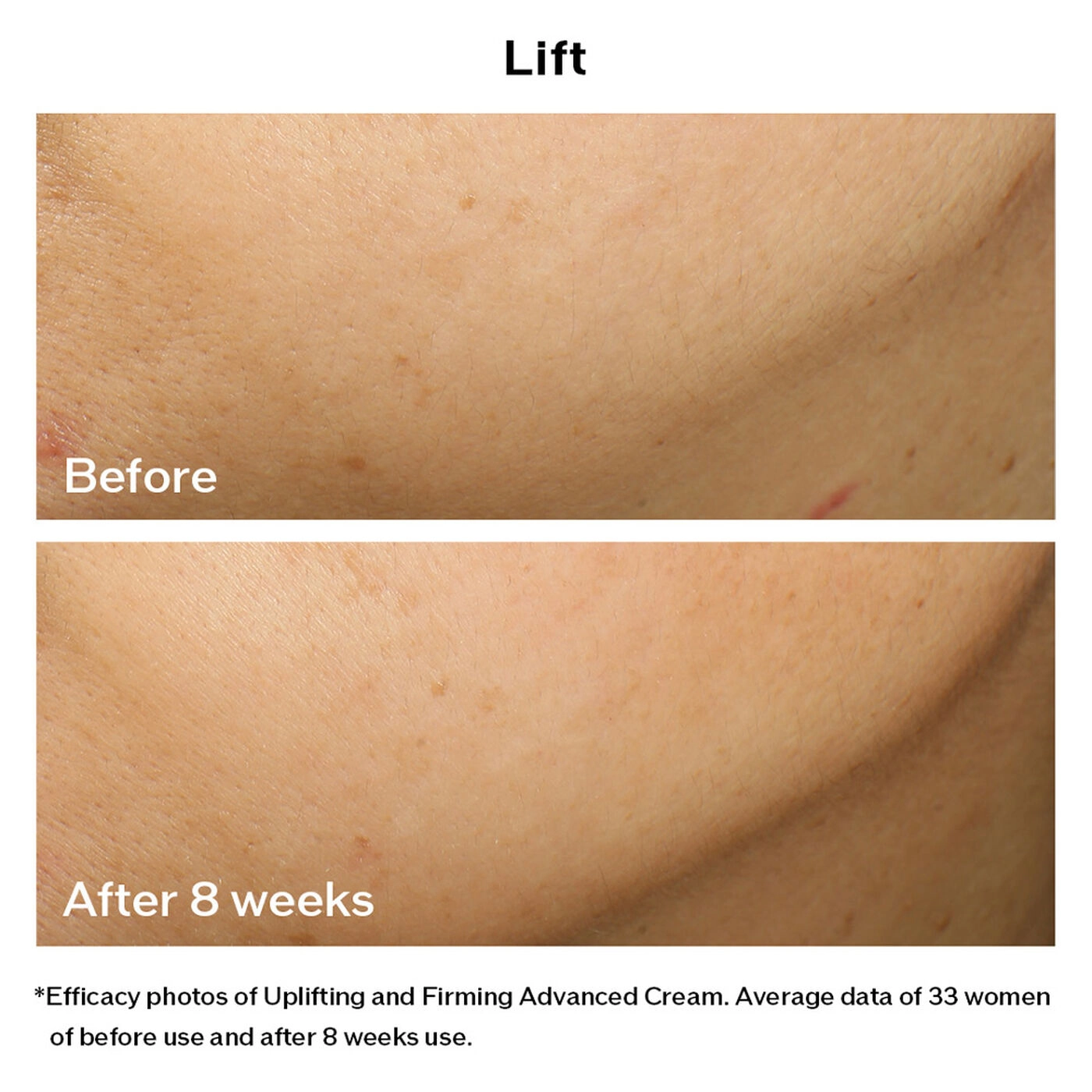 Kem dưỡng da chống lão hóa Shiseido Vital-Perfection Uplifting and Firming Advanced Cream 50ml