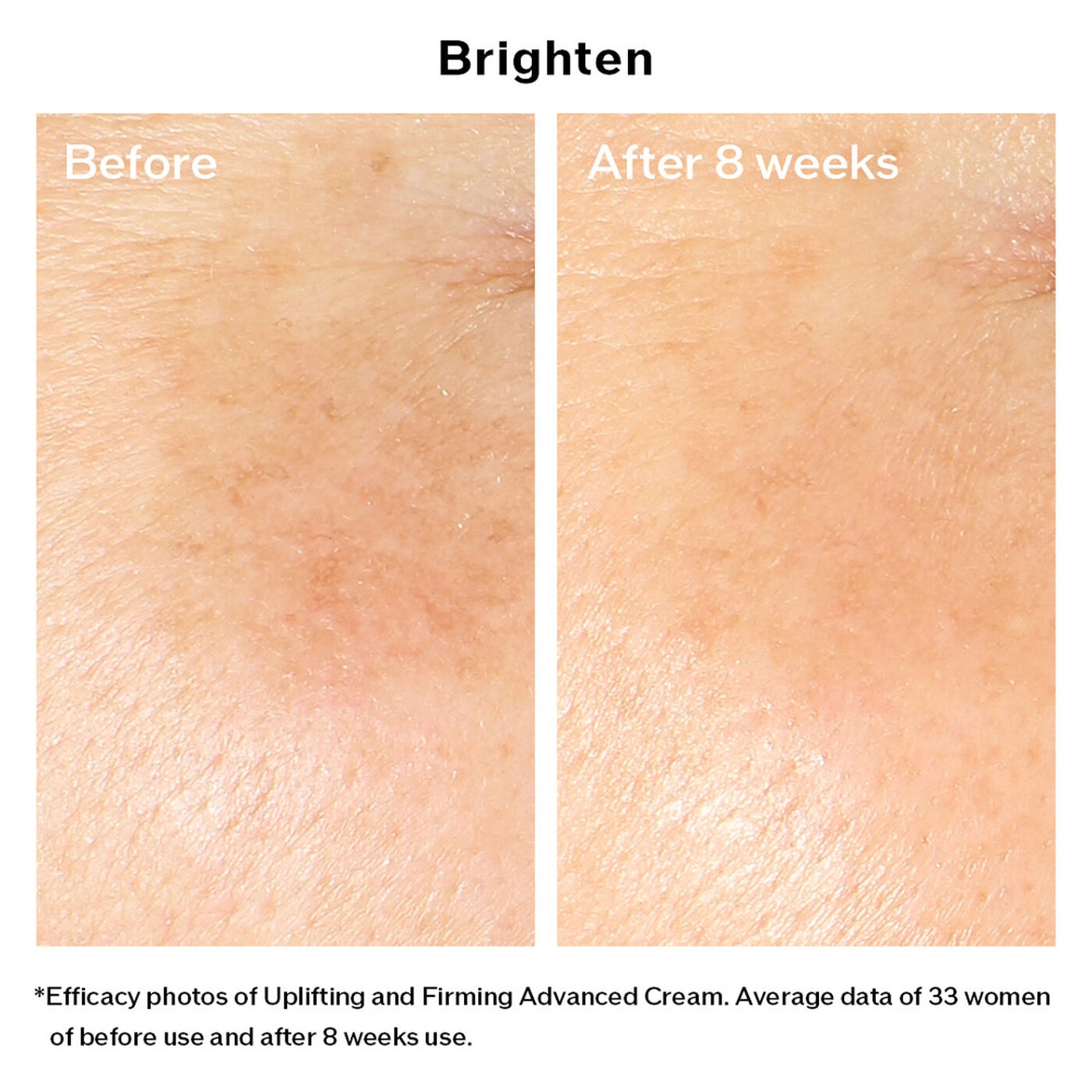Kem dưỡng da chống lão hóa Shiseido Vital-Perfection Uplifting and Firming Advanced Cream 50ml