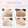 Gel làm sáng da, giảm mụn lưng Carico Silky Back Whitening & Acne Care Gel 100g