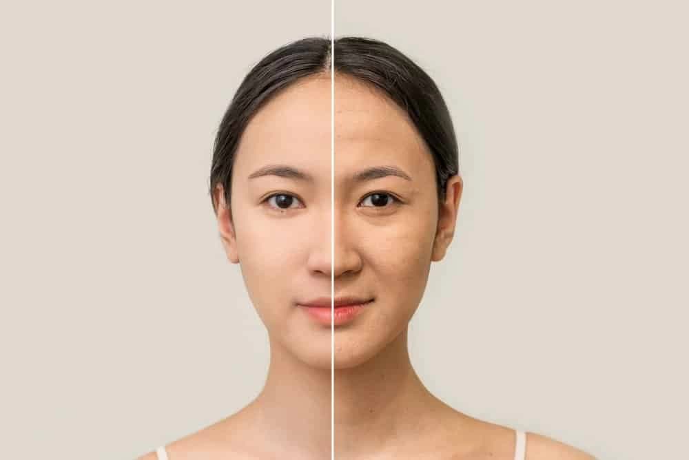 Lão Hóa Da Là Gì? 5 Cách Ngăn Ngừa Da Lão Hóa Sớm