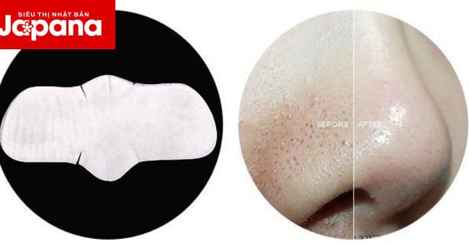 5 thói quen giúp bạn đánh bay mụn đầu đen cứng đầu trên da mặt