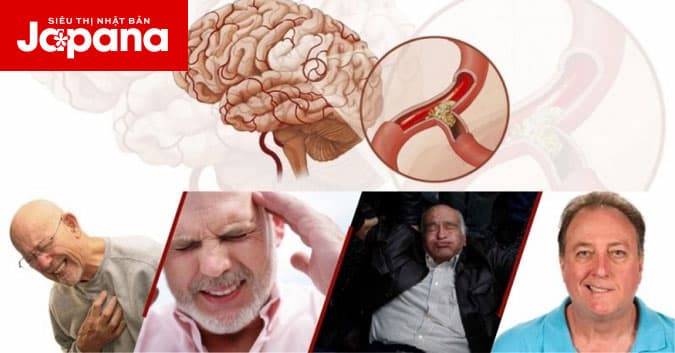 TOP 9 viên uống hỗ trợ điều trị tai biến mạch máu não tốt nhất hiện nay
