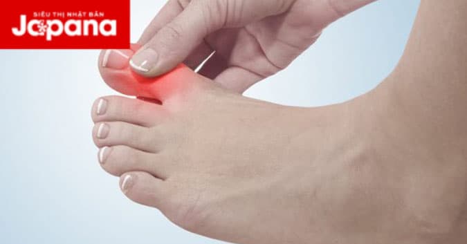 Chữa gout từ quả đu đủ và lá trà xanh hiệu quả khiến bạn không ngờ tới