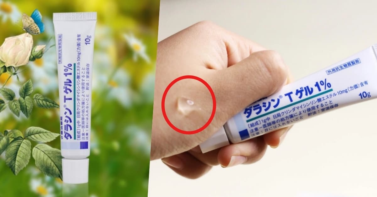 Cách phân biệt kem trị mụn Dalacin T 1% thật giả đơn giản nhất!