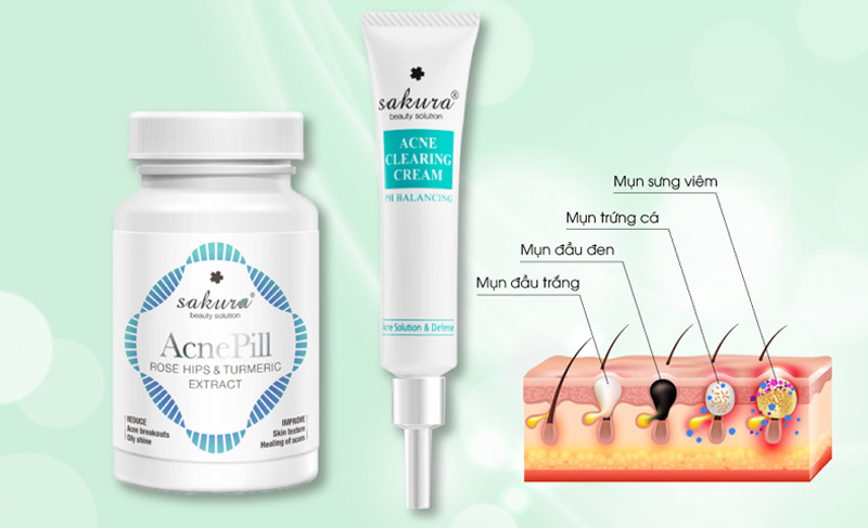 Kem trị mụn Sakura Beauty Solution Acne Clearing Cream 25g