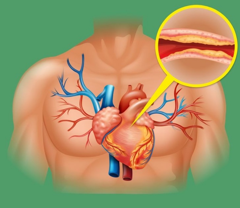 Cải thiện sức khỏe tim mạch