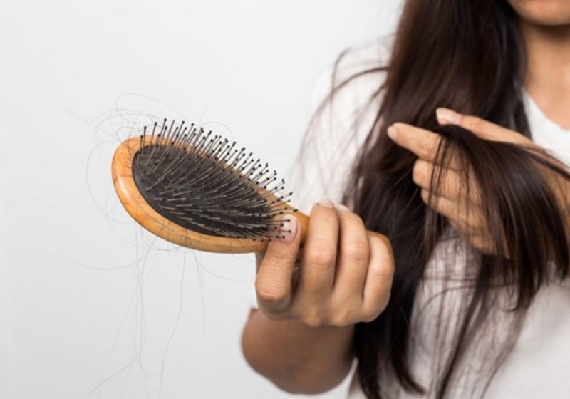 rụng tóc sau sinh