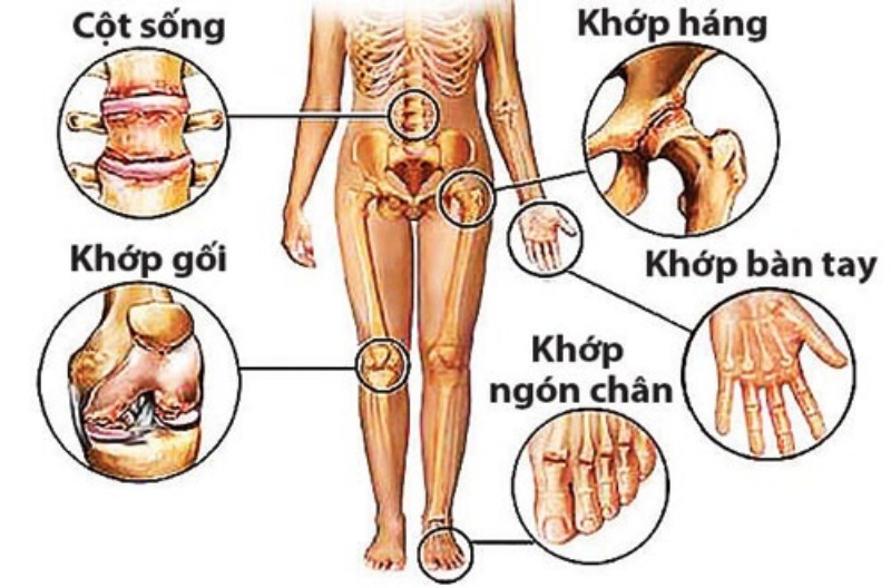 Canxi đóng vai trò thế nào với bộ xương?