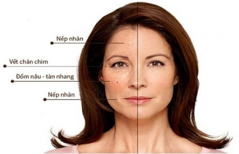 Sau 40 tuổi làn da và sức khoẻ của phụ nữ nếu thiếu collagen sẽ bị ảnh hưởng rất nhiều