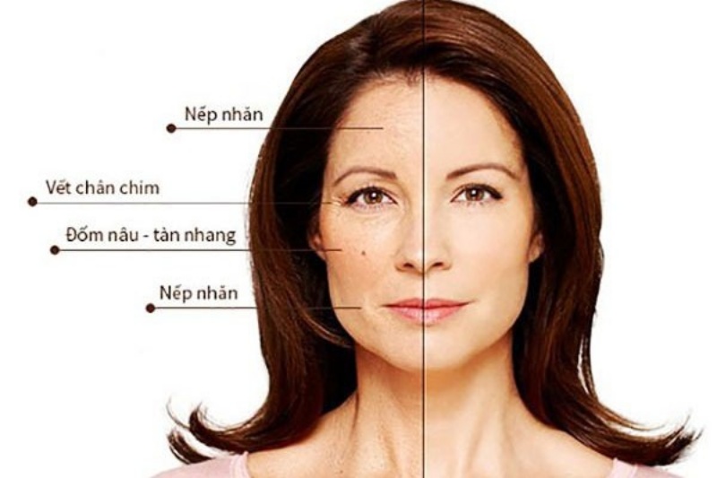 Phụ nữ tuổi trung niên nên tìm hiểu kỹ trước khi serum chống lão hóa