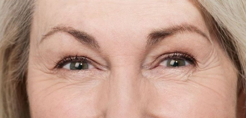 Có nhiều nguyên nhân khiến vùng da quanh mắt khô nhăn