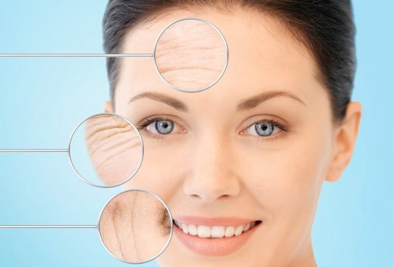 Các nếp nhăn ban đầu chỉ nhỏ và mờ, sau dần dần rõ hơn và hằn luôn trên da