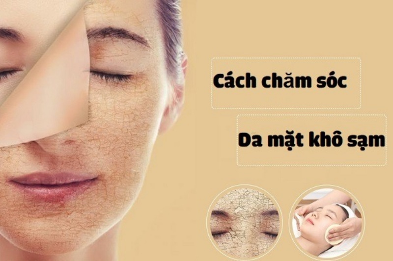 Chăm sóc hiệu quả cho da mặt khô như thế nào?