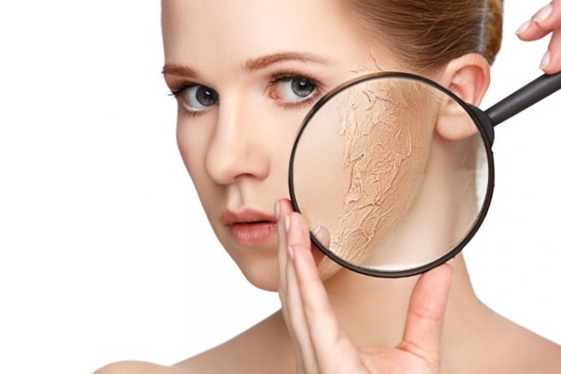 Làn da khô khiến nhiều chị em mất tự tin