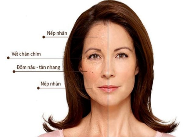 Thiếu hụt collagen khiến nhan sắc xuống cấp, da nhăn nheo, chảy xệ