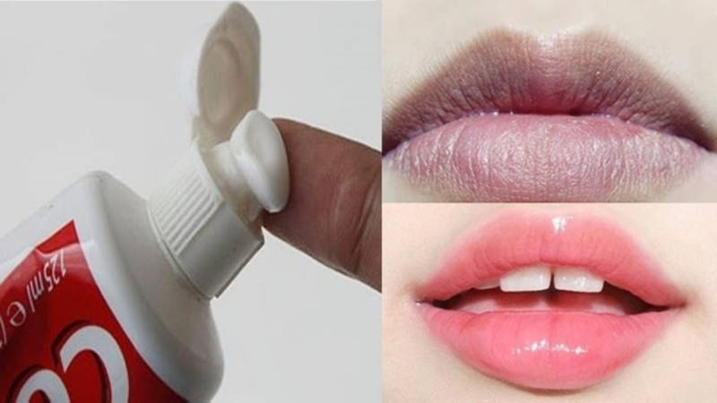 Trị thâm môi bằng kem đánh răng cực đơn giản