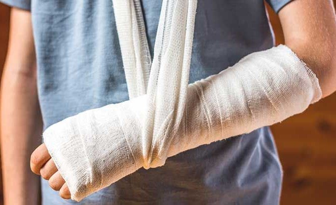 Bị Gãy Chân Tay, Gãy Xương Có Nên Quan Hệ Không? Mách Tư Thế Làm Chuyện Ấy  Không Ảnh Hưởng Sức Khỏe