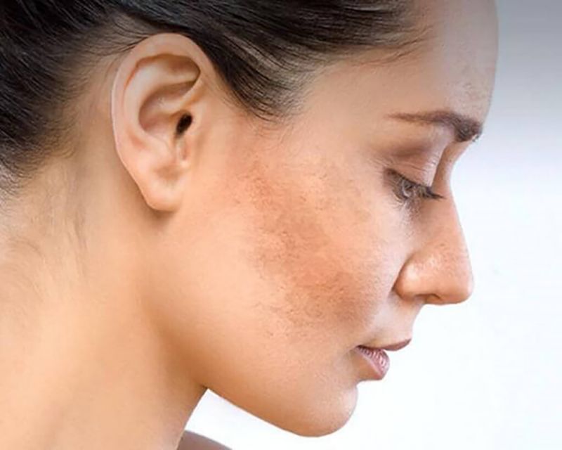 Collagen là gì? Tác dụng của collagen