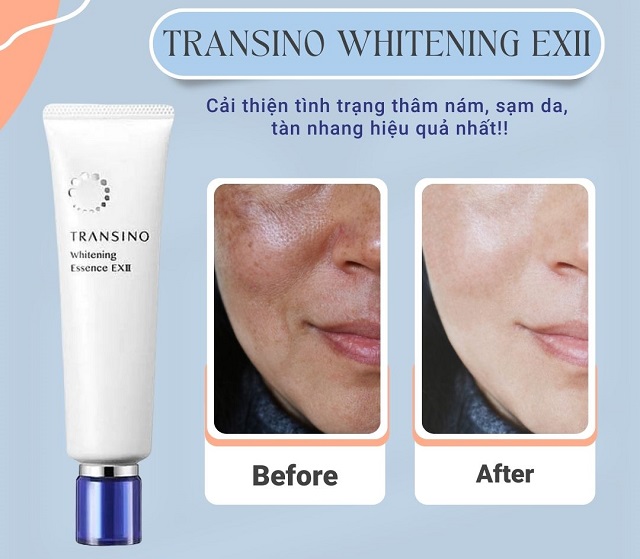 kem-tri-nam-Transino-Whitening-Essence-EX-co-tot-khong