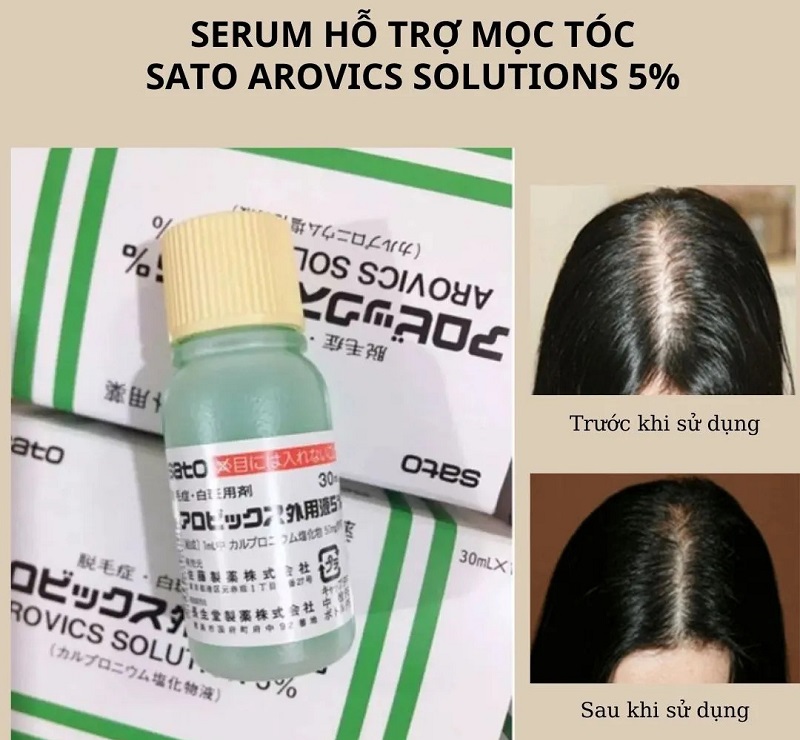 Tinh chất thảo dược kích thích mọc tóc Sato Arovics Solutions 5% 30ml