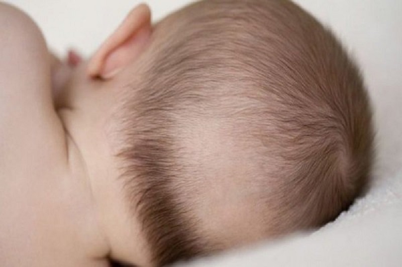 Cách chữa rụng tóc vành khăn ở trẻ sơ sinh