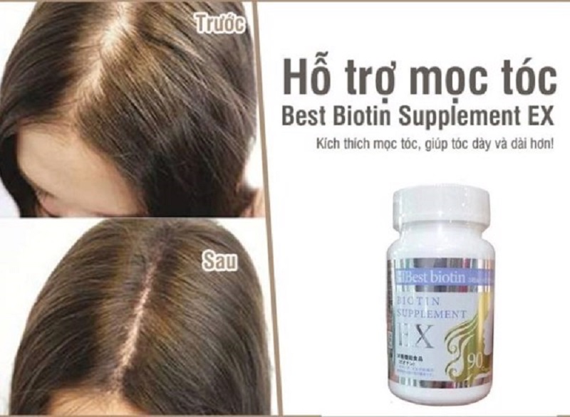 Viên uống mọc tóc Best Biotin Supplement EX