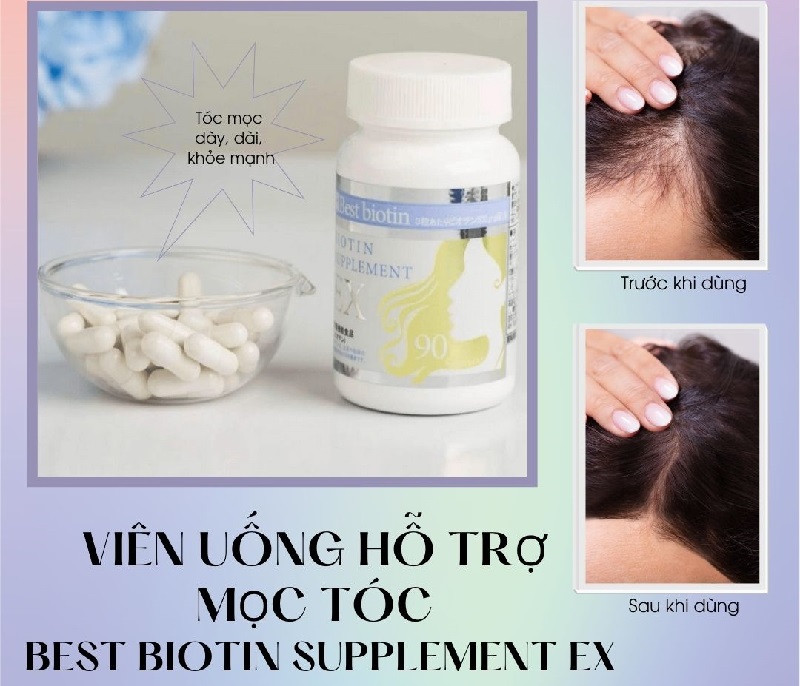 Viên uống mọc tóc Biotin của Nhật