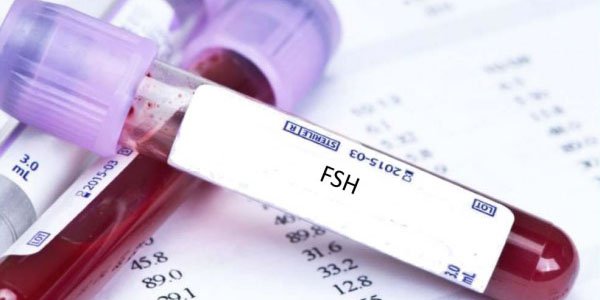 Chi phí xét nghiệm nội tiết tố nữ tại các cơ sở y tế