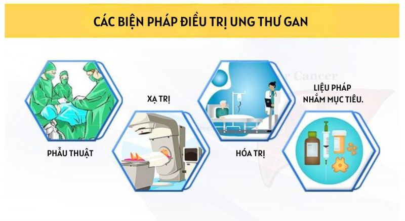 cac-bien-phap-dieu-tri-ung-thu-gan