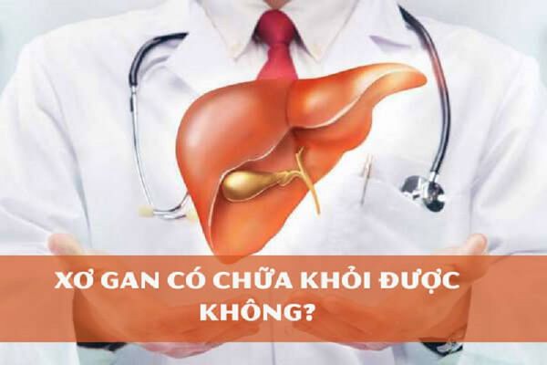 xo-gan-f4-chua-duoc-khong