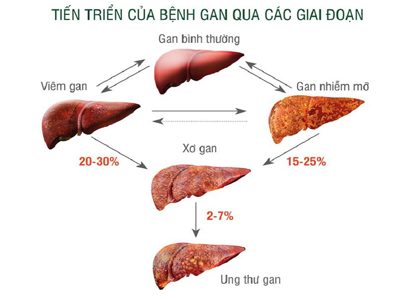 xo-gan-f4-nguy-hiem-khong