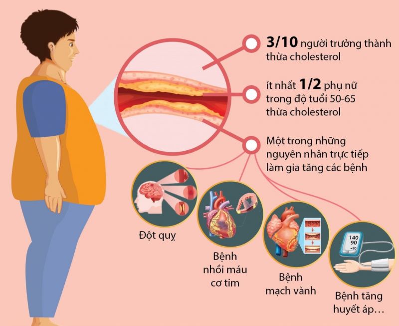 Rối loạn lipid máu làm tăng nguy cơ đột quỵ. Nguồn: Internet