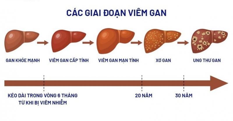 Mức độ 4