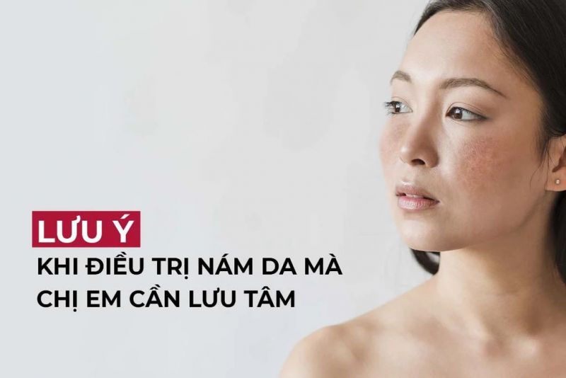 Lưu ý trong quá trình điều trị nám da