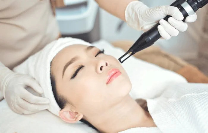 Sử dụng liệu trình laser trị nám