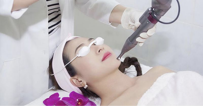 Phương pháp laser trị nám
