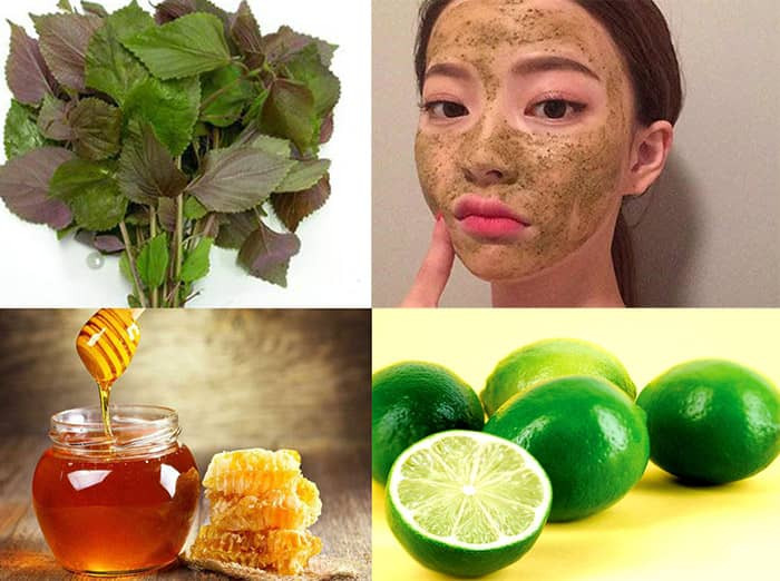 Điều trị nám với Lá tía tô, chanh tươi và mật ong