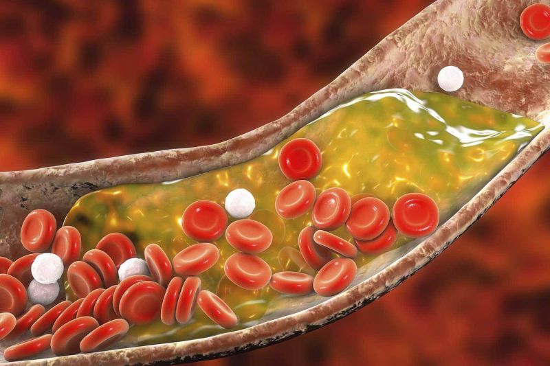 Giảm hàm lượng triglycerid và cholesterol