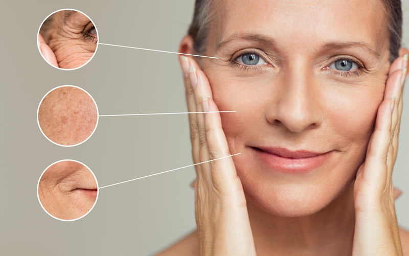sụt giảm Collagen và Elastin theo thời gian