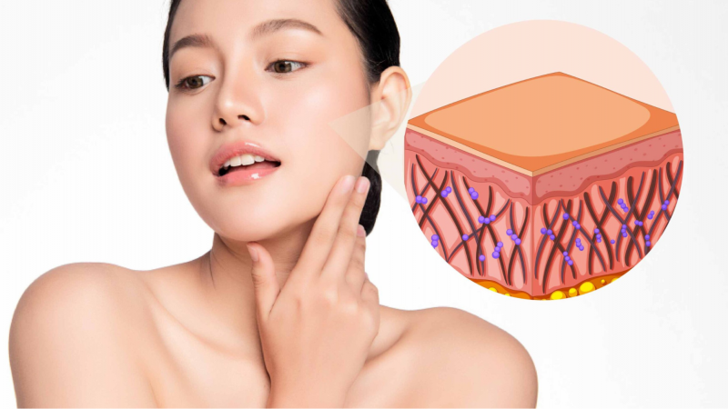 Elastin khác collagen như thế nào?