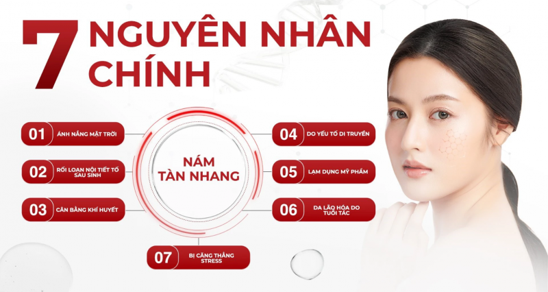 Nám da là bệnh lý thường gặp ở phụ nữ xuất hiện sau tuổi 30 