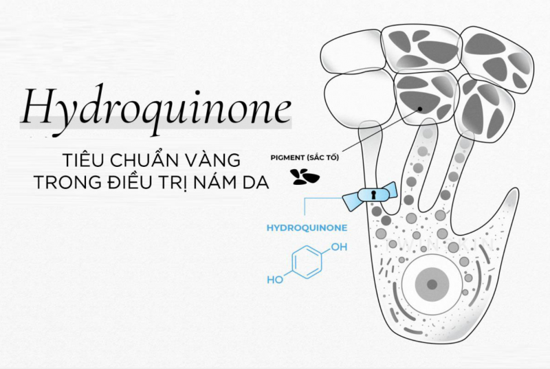 Hydroquinone là hoạt chất vàng trong điều trị nám da