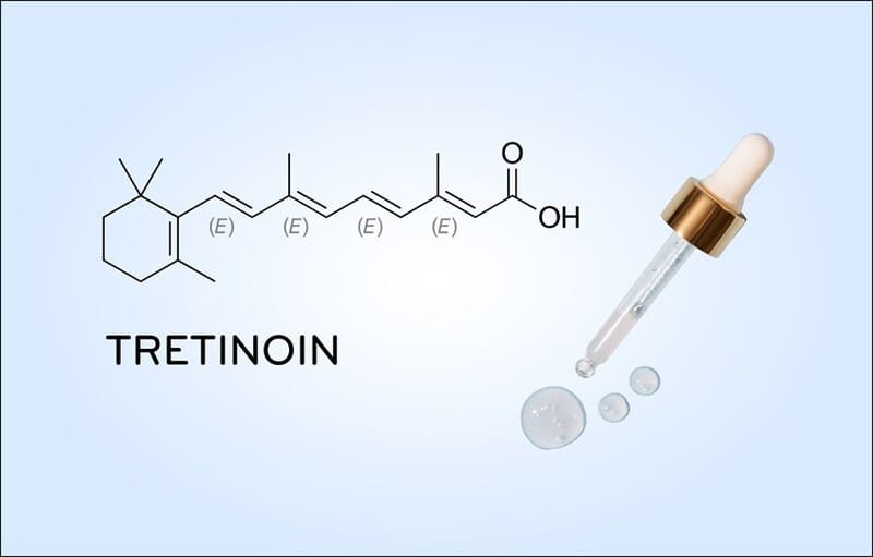 Kết hợp giữa hoạt chất Tretinoin và Corticosteroid trong điều trị nám da